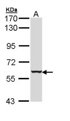 Western Blot: Cytokeratin 4 Antibody [NBP1-33412]