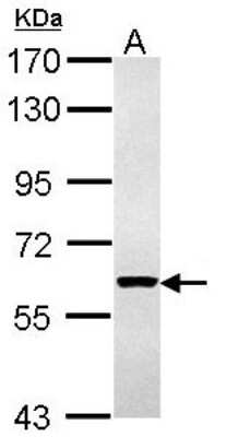 Western Blot: Cytokeratin 4 Antibody [NBP1-33592]