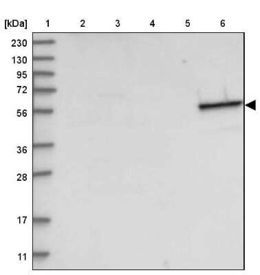 Western Blot: Cytokeratin 4 Antibody [NBP2-33984]