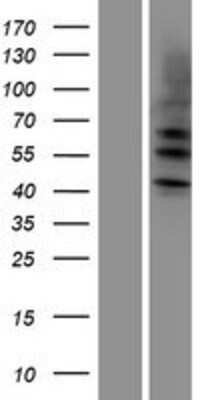 Western Blot: Cytokeratin 4 Overexpression Lysate [NBP2-10820]