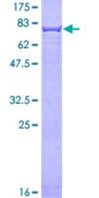 SDS-PAGE: Recombinant Human Cytokeratin 4 GST (N-Term) Protein [H00003851-P01]