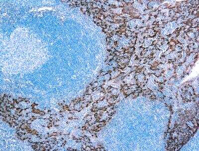 Immunohistochemistry-Paraffin: Cytokeratin 5/14 Antibody (XM26/LL002) [NB110-59922]