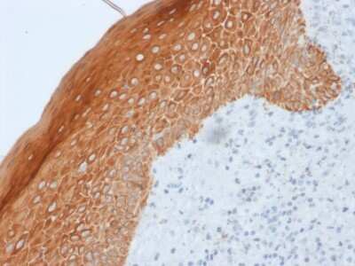 Immunohistochemistry-Paraffin: Cytokeratin 5/6/18 Antibody (LP34) [NBP3-07605]