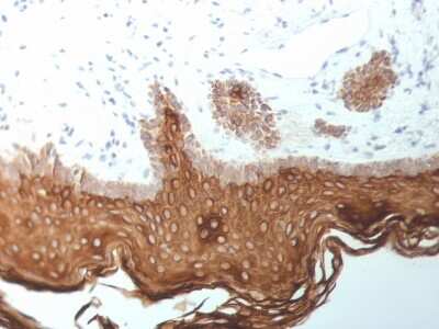 Immunohistochemistry-Paraffin: Cytokeratin 5/6/18 Antibody (SPM267) [NBP3-07606]