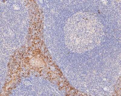 Immunohistochemistry-Paraffin: Cytokeratin 5/6 Antibody (A2A12) [NBP2-80401]