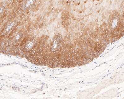 Immunohistochemistry-Paraffin: Cytokeratin 5/6 Antibody (A2A12) [NBP2-80401]