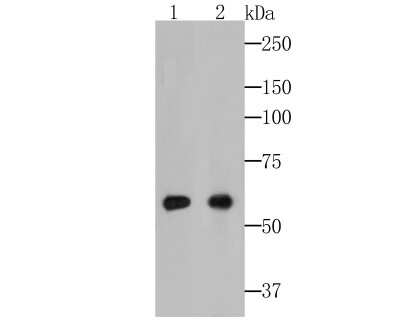 Western Blot: Cytokeratin 5/6 Antibody (A2A12) [NBP2-80401]