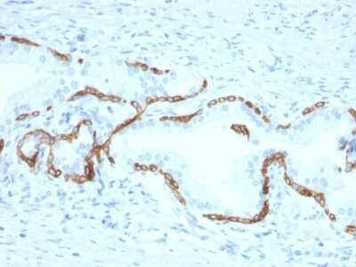 Immunohistochemistry-Paraffin: Cytokeratin 5/6 Antibody (KRT5.6/2438) - Azide and BSA Free [NBP3-08622]
