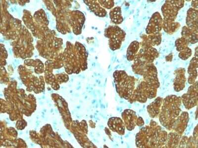 Immunohistochemistry-Paraffin: Cytokeratin 5/6 Antibody (KRT5.6/2438) - Azide and BSA Free [NBP3-08622]