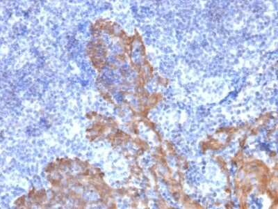 Immunohistochemistry-Paraffin: Cytokeratin 5/6 Antibody (KRT5.6/2438) - Azide and BSA Free [NBP3-08622]