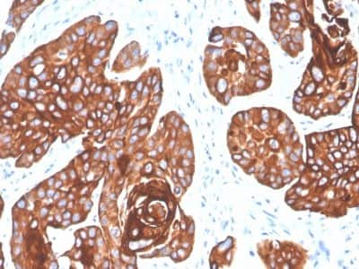 Immunohistochemistry-Paraffin: Cytokeratin 5/6 Antibody (KRT5.6/4866) - Azide and BSA Free [NBP3-08683]