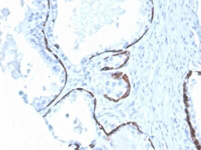 Immunohistochemistry-Paraffin: Cytokeratin 5/6 Antibody (KRT5.6/4866) - Azide and BSA Free [NBP3-08683]