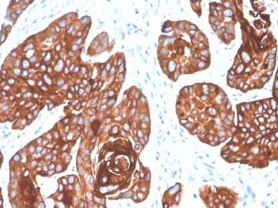 Immunohistochemistry-Paraffin: Cytokeratin 5/6 Antibody (KRT5.6/4866) [NBP3-07646]