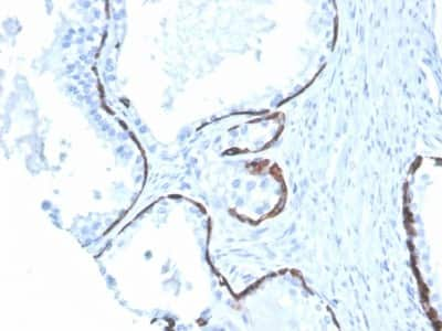 Immunohistochemistry-Paraffin: Cytokeratin 5/6 Antibody (KRT5.6/4866) [NBP3-07646]