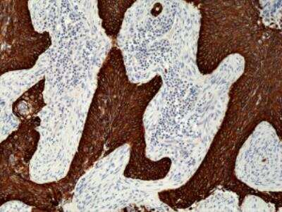 Immunohistochemistry-Paraffin: Cytokeratin 5/6 Antibody (RM341) [NBP2-77439]