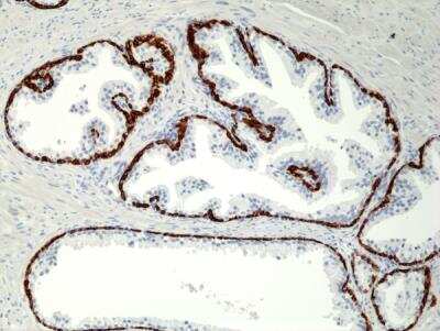 Immunohistochemistry-Paraffin: Cytokeratin 5/6 Antibody (RM341) [NBP2-77439]
