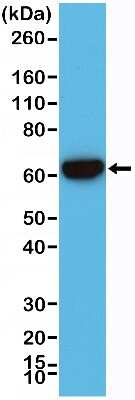 Western Blot: Cytokeratin 5/6 Antibody (RM341) [NBP2-77439]