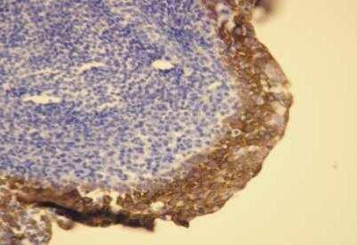 Immunohistochemistry-Paraffin: Cytokeratin 5/6 Antibody (T16-K) [NBP2-36738]