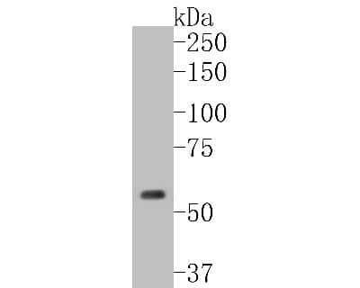 Western Blot: Cytokeratin 5/75 Antibody (SC62-04) [NBP2-67586]