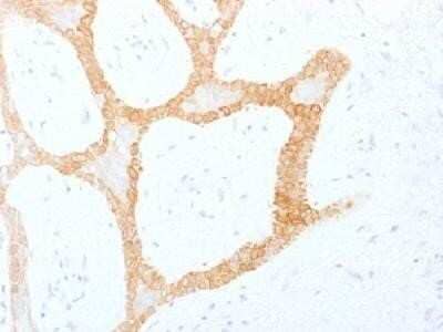 Immunohistochemistry-Paraffin: Cytokeratin 5/8 Antibody (C-50) - IHC-Prediluted [NBP2-48102]