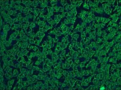 Immunohistochemistry-Frozen: Cytokeratin 5/8 Antibody (RCK102) - BSA Free [NBP1-97730]