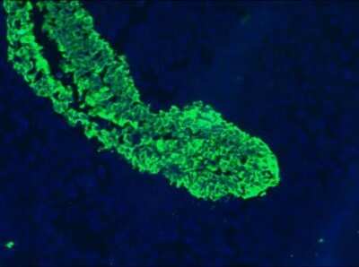 Immunohistochemistry-Frozen: Cytokeratin 5/8 Antibody (RCK102) - BSA Free [NBP1-97730]