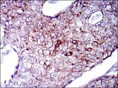 Immunohistochemistry-Paraffin: Cytokeratin 5 Antibody (2C2) - BSA Free [NBP2-22194]