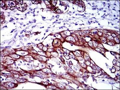 Immunohistochemistry-Paraffin: Cytokeratin 5 Antibody (2C2) - BSA Free [NBP2-22194]