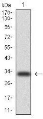 Western Blot: Cytokeratin 5 Antibody (2C2)BSA Free [NBP2-22194]