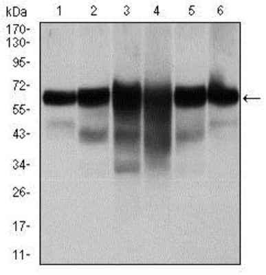 Western Blot: Cytokeratin 5 Antibody (2C2)BSA Free [NBP2-22194]