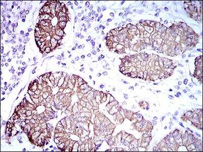 Immunohistochemistry-Paraffin: Cytokeratin 5 Antibody (2C2B4) - BSA Free [NBP2-37373]