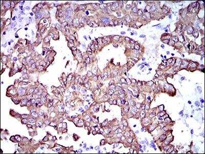 Immunohistochemistry-Paraffin: Cytokeratin 5 Antibody (2C2B4) - BSA Free [NBP2-37373]