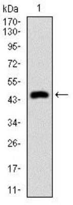 Western Blot: Cytokeratin 5 Antibody (2C2B4)BSA Free [NBP2-37373]