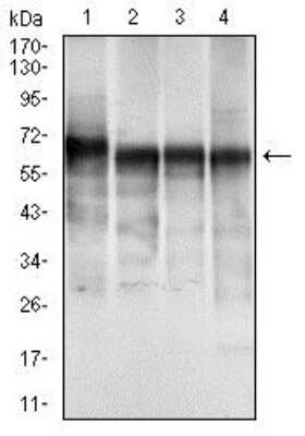 Western Blot: Cytokeratin 5 Antibody (2C2B4)BSA Free [NBP2-37373]