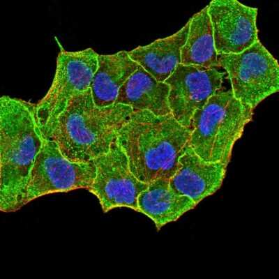 Immunocytochemistry/ Immunofluorescence: Cytokeratin 5 Antibody (2C8E4) - BSA Free [NBP2-52443]