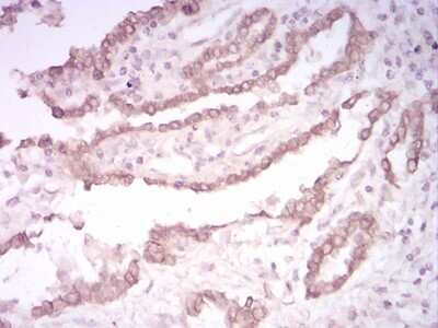 Immunohistochemistry: Cytokeratin 5 Antibody (2C8E4) - BSA Free [NBP2-52443]