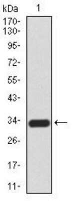 Western Blot: Cytokeratin 5 Antibody (2C8E4)BSA Free [NBP2-52443]
