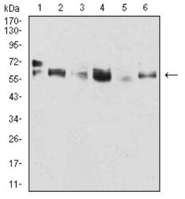 Western Blot: Cytokeratin 5 Antibody (2C8E4)BSA Free [NBP2-52443]