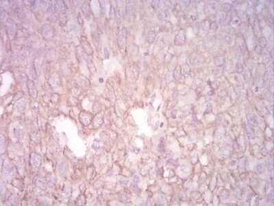 Immunohistochemistry: Cytokeratin 5 Antibody (3D6D4) - BSA Free [NBP2-52444]