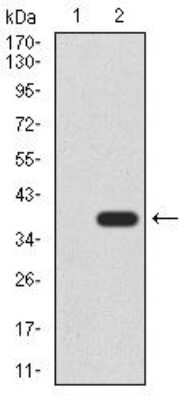 Western Blot: Cytokeratin 5 Antibody (3D6D4)BSA Free [NBP2-52444]