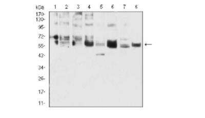 Western Blot: Cytokeratin 5 Antibody (3D6D4)BSA Free [NBP2-52444]