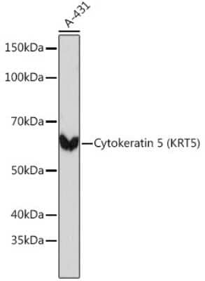 Western Blot: Cytokeratin 5 Antibody (3P3T9) [NBP3-15374]