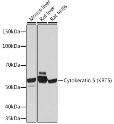 Western Blot: Cytokeratin 5 Antibody (3P3T9) [NBP3-15374]