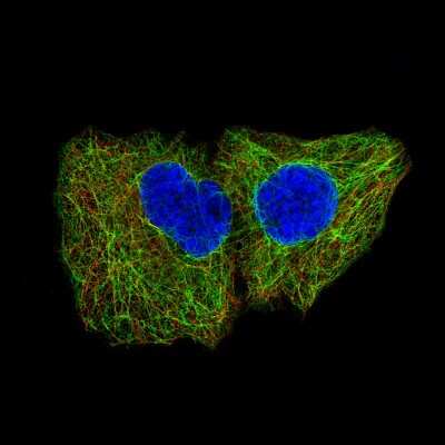 Immunocytochemistry/ Immunofluorescence: Cytokeratin 5 Antibody (CL9297) [NBP2-88923]
