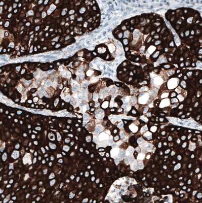 Immunohistochemistry-Paraffin: Cytokeratin 5 Antibody (CL9297) [NBP2-88923]