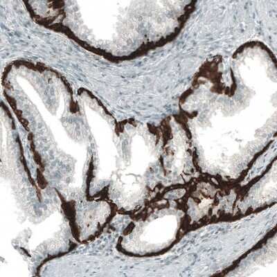 Immunohistochemistry-Paraffin: Cytokeratin 5 Antibody (CL9297) [NBP2-88923]