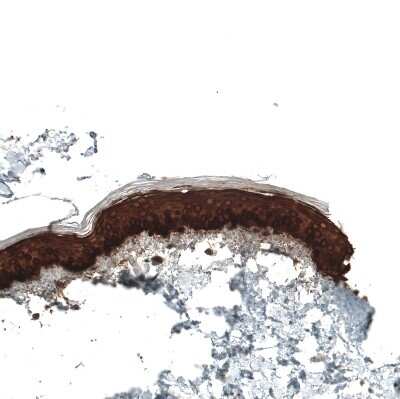 Immunohistochemistry-Paraffin: Cytokeratin 5 Antibody (CL9297) [NBP2-88923]