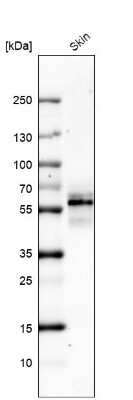 Western Blot: Cytokeratin 5 Antibody (CL9297) [NBP2-88923]