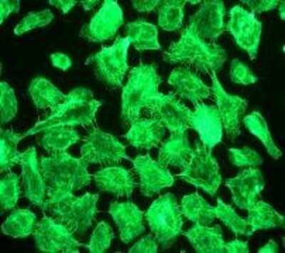Immunocytochemistry/ Immunofluorescence: Cytokeratin 5 Antibody (EP1601Y) [NB110-56916]