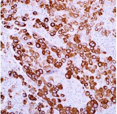 Immunohistochemistry-Paraffin: Cytokeratin 5 Antibody (EP1601Y) [NB110-56916]